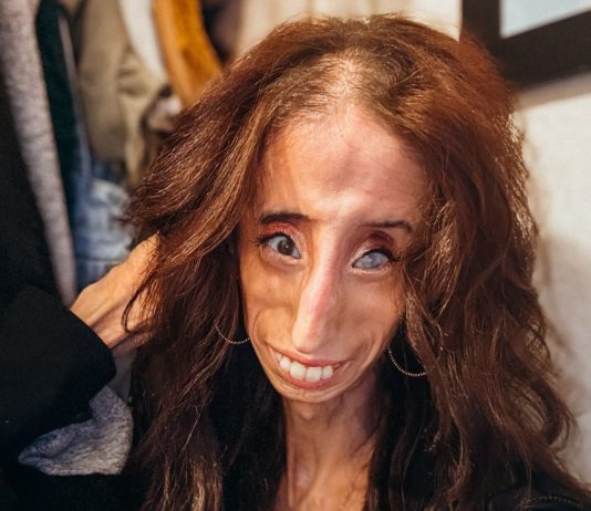 Una mujer catalogada como "la más fea del mundo" convierte el acoso en inspiración mundial (Foto: Instagram)